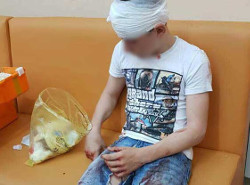 Ребенок разбил голову в батутном центре